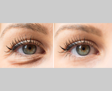 estetica-ocular